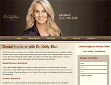 Tablet Screenshot of dentalimplantsftworth.com